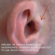 Illustration for article titled Implanted headphones!